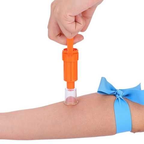 Перша допомога при укусі змії — покроковий алгоритм
